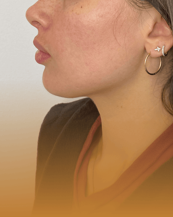 LIPOPAPADA