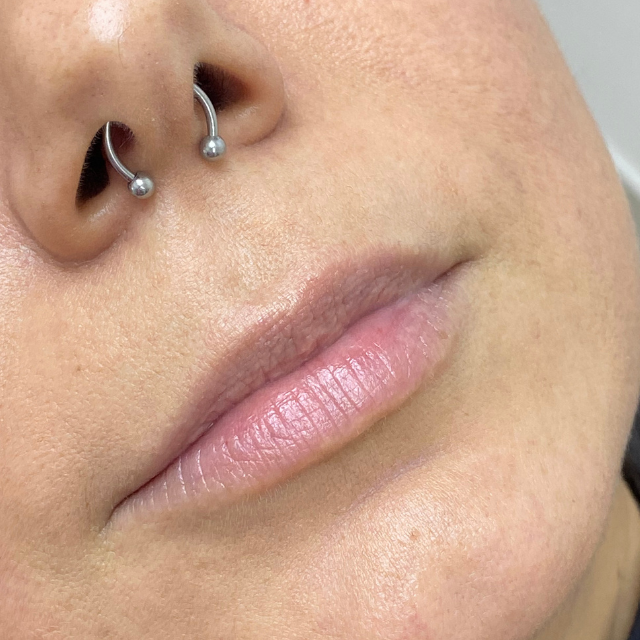 Before-Labios