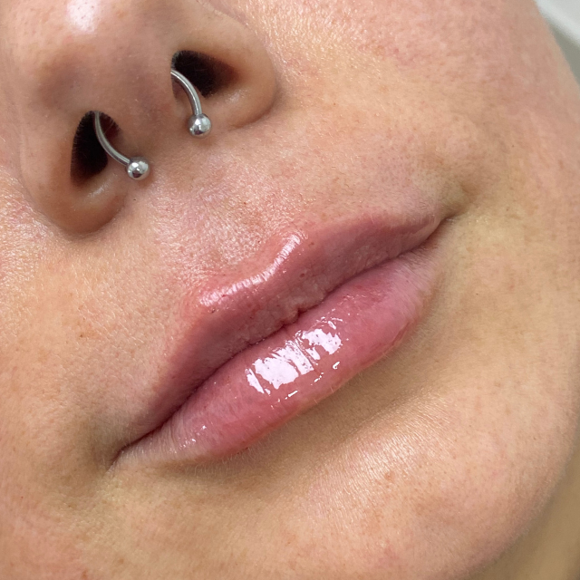 After-Labios