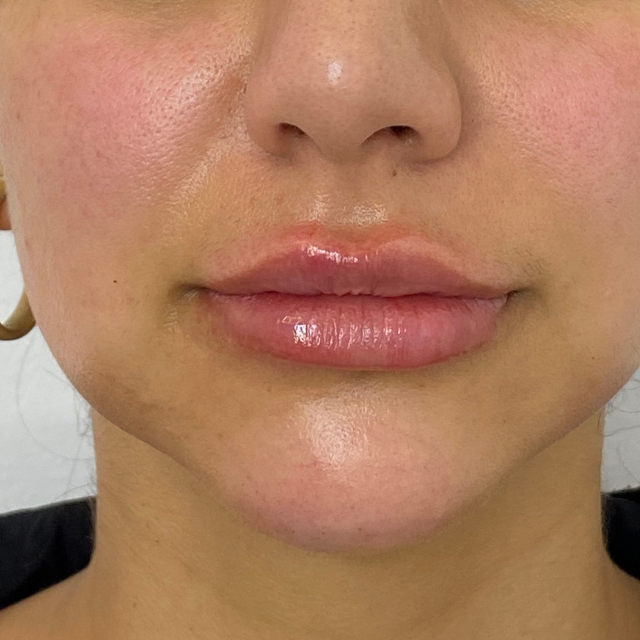 After-Labios